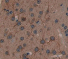 Nitric Oxide Synthase 1, Neuronal (NOS1) Polyclonal Antibody - image 3