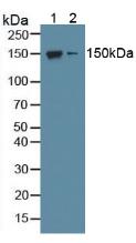 Western Blot; Sample: Recombinant NOS1, Mouse.