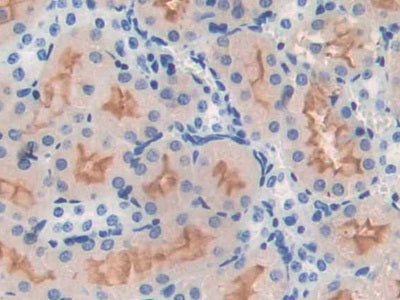 DAB staining on IHC-P; Samples: Mouse Brain Tissue.
