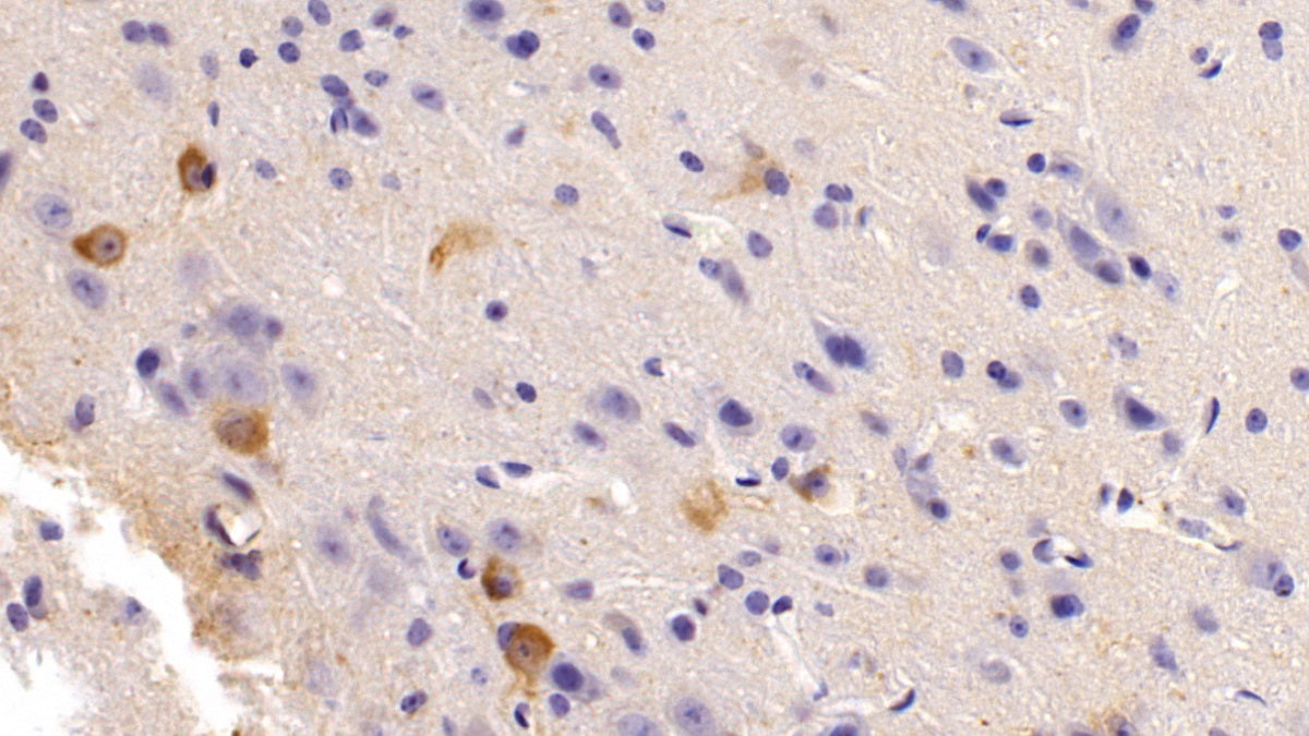 Nitric Oxide Synthase 1, Neuronal (NOS1) Polyclonal Antibody - image 5