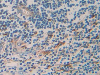DAB staining on fromalin fixed paraffin-embedded Kidney tissue)