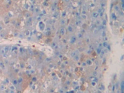 Tumor Necrosis Factor Receptor Superfamily, Member 12A (TNFRSF12A) Polyclonal Antibody - image 4