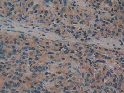 DAB staining on IHC-P; Samples: Human Prostate Gland Tissue