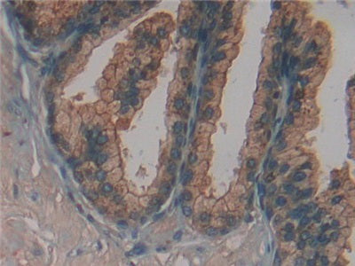 Fucosidase Alpha L1, Tissue (FUCa1) Polyclonal Antibody - image 5