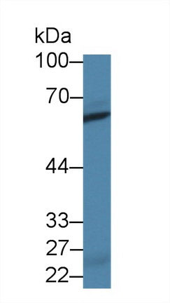 Western Blot; Sample: Recombinant protein.