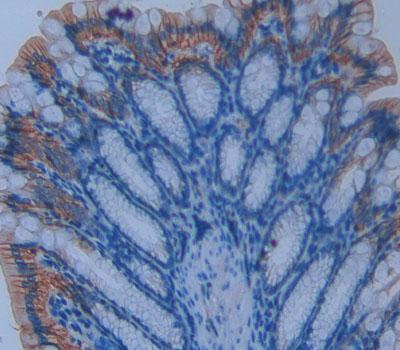 Alkaline Sphingomyelinase (Alk-Smase) Polyclonal Antibody - image 4