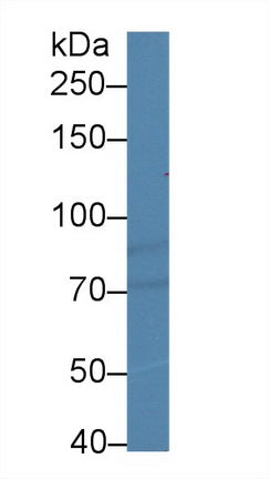 Western Blot; Sample: Recombinant protein.