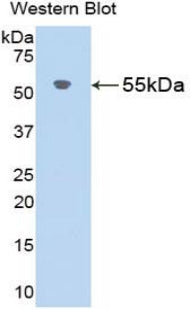 DAB staining on IHC-P; Samples: Rat Kidney Tissue;  Primary Ab: 20μg/ml Rabbit Anti-Rat AGT Antibody Second Ab: 2µg/mL HRP-Linked Caprine Anti-Rabbit IgG Polyclonal Antibody