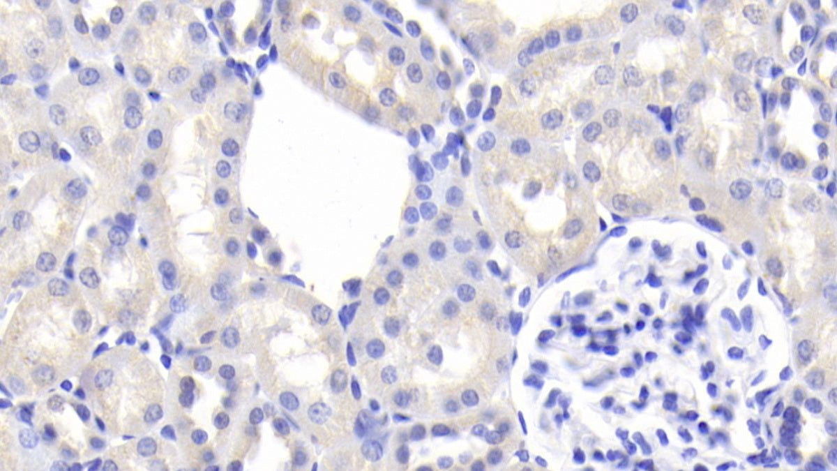 Angiotensinogen (AGT) Polyclonal Antibody - image 4