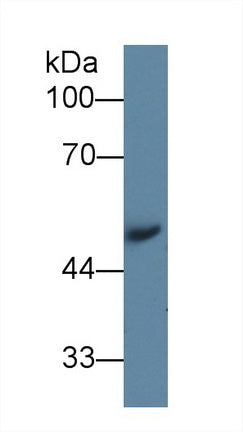 Western Blot; Sample: Recombinant protein.