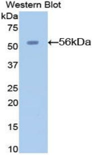 Used in DAB staining on fromalin fixed paraffin-embedded Liver tissue