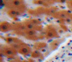 Angiotensinogen (AGT) Polyclonal Antibody - image 4