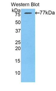 Angiotensinogen (AGT) Polyclonal Antibody - image 2