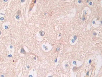 DAB staining on IHC-P; Samples: Human Prostate Tissue)