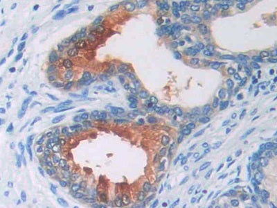 Angiotensinogen (AGT) Polyclonal Antibody - image 4
