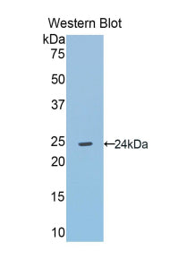 Angiotensinogen (AGT) Polyclonal Antibody - image 2