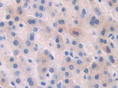 DAB staining on IHC-P; Samples: Human Pancreas Tissue; Primary Ab: 30µg/ml Rabbit Anti-Human AGT Antibody Second Ab: 2µg/mL HRP-Linked Caprine Anti-Rabbit IgG Polyclonal Antibody