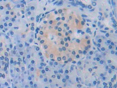 Angiotensinogen (AGT) Polyclonal Antibody - image 4