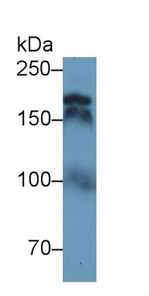 Western Blot; Sample: Recombinant protein.