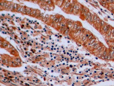DAB staining on fromalin fixed paraffin-embedded Ovary tissue)