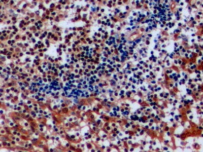 Topoisomerase II (TOP2) Polyclonal Antibody - image 5