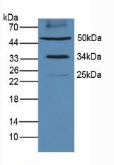 Western Blot; Sample: Recombinant protein.