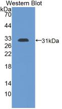 DAB staining on IHC-P; Samples: Mouse Kidney Tissue; Primary Ab: 10µg/ml Rabbit Anti-Mouse PDCD1LG1 Antibody Second Ab: 2µg/mL HRP-Linked Caprine Anti-Rabbit IgG Polyclonal Antibody