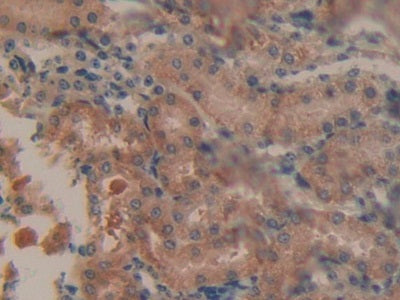 DAB staining on IHC-P. Samples: Mouse Liver Tissue
