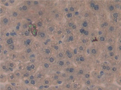 Programmed Cell Death Protein 1 Ligand 1 (PDL1) Polyclonal Antibody - image 5