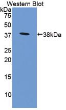 DAB staining on IHC-P; Samples: Mouse Testis Tissue; Primary Ab: 10µg/ml Rabbit Anti-Mouse PDCD1LG1 Antibody Second Ab: 2µg/mL HRP-Linked Caprine Anti-Rabbit IgG Polyclonal Antibody