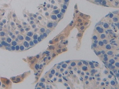 DAB staining on IHC-P; Samples: Mouse Liver Tissue.