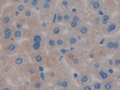 Programmed Cell Death Protein 1 Ligand 1 (PDL1) Polyclonal Antibody - image 5