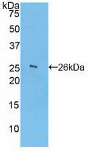 Used in DAB staining on fromalin fixed paraffin-embedded Spleen tissue