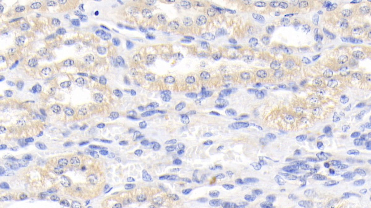 DAB staining on IHC-P; Samples: Canine Colon Tissue;  Primary Ab: 20μg/ml Rabbit Anti-Canine Kim1 Antibody Second Ab: 2µg/mL HRP-Linked Caprine Anti-Rabbit IgG Polyclonal Antibody