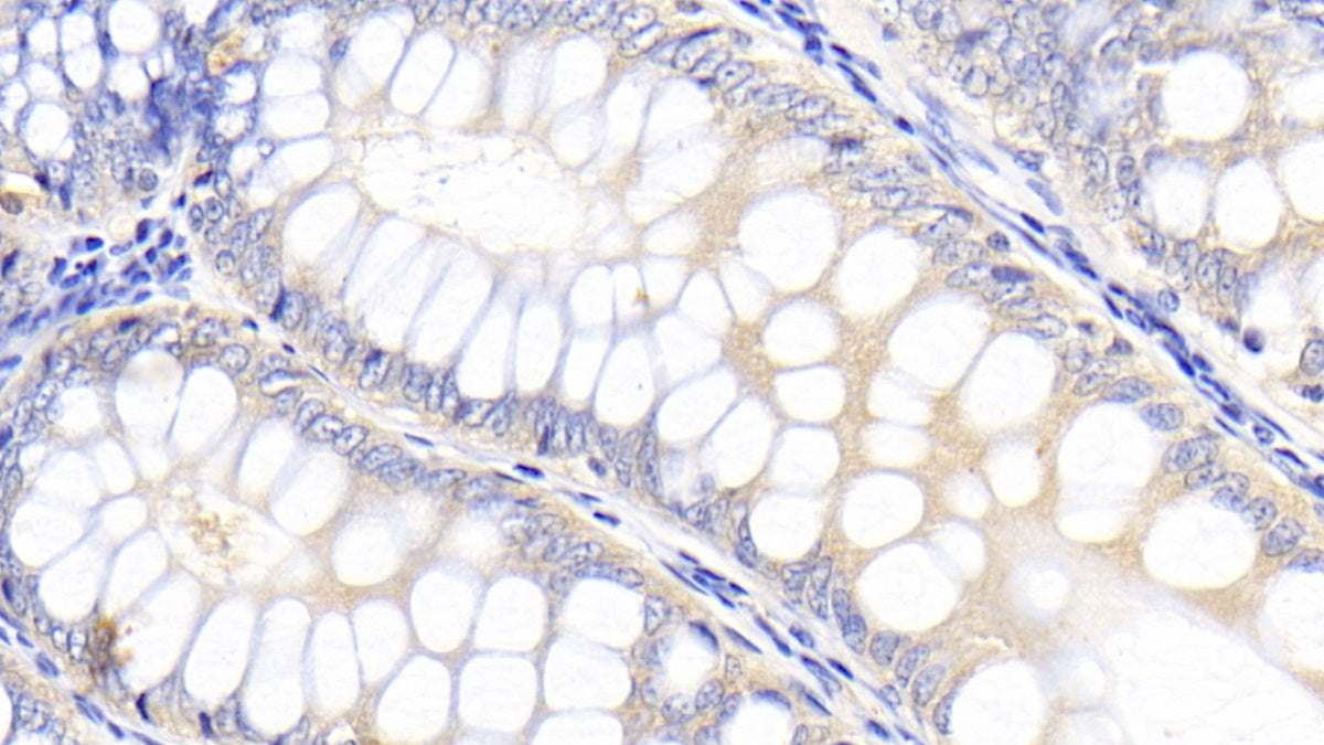 Kidney Injury Molecule 1 (Kim1) Polyclonal Antibody - image 5