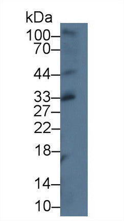 Western Blot; Sample: Recombinant protein.