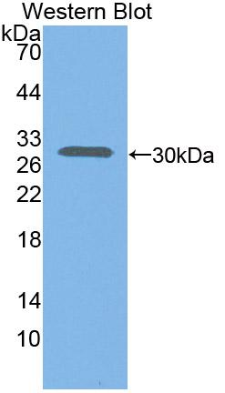 DAB staining on IHC-P; Samples: Mouse Intestine Tissue; Primary Ab: 10µg/ml Rabbit Anti-Mouse CXCL16 Antibody Second Ab: 2µg/mL HRP-Linked Caprine Anti-Rabbit IgG Polyclonal Antibody