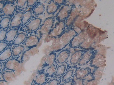 DAB staining on fromalin fixed paraffin- embedded testis tissue)