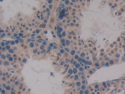 Chemokine C-X-C-Motif Ligand 16 (CXCL16) Polyclonal Antibody - image 5