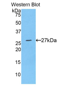 A Disintegrin And Metalloprotease 10 (ADAM10) Polyclonal Antibody - image 2