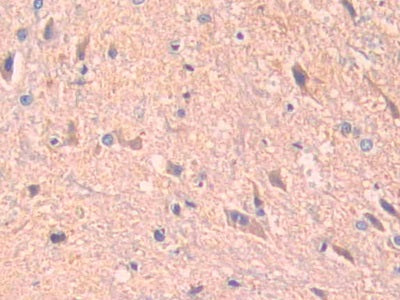 DAB staining on fromalin fixed paraffin- embedded kidney tissue)