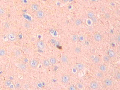 A Disintegrin And Metalloprotease 10 (ADAM10) Polyclonal Antibody - image 4
