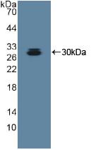 DAB staining on IHC-P; Samples: Human Stomach Tissue; Primary Ab: 30µg/ml Rabbit Anti-Human ADAM10 Antibody Second Ab: 2µg/mL HRP-Linked Caprine Anti-Rabbit IgG Polyclonal Antibody