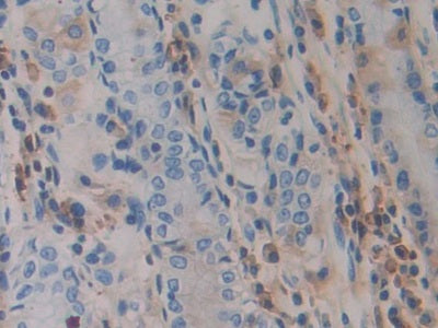 A Disintegrin And Metalloprotease 10 (ADAM10) Polyclonal Antibody - image 4
