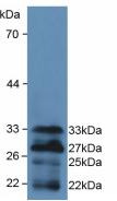 DAB staining on IHC-P; Samples: Mouse Testis Tissue; Primary Ab: 20μg/ml Rabbit Anti-Mouse FOXO1 Antibody Second Ab: 2µg/mL HRP-Linked Caprine Anti-Rabbit IgG Polyclonal Antibody