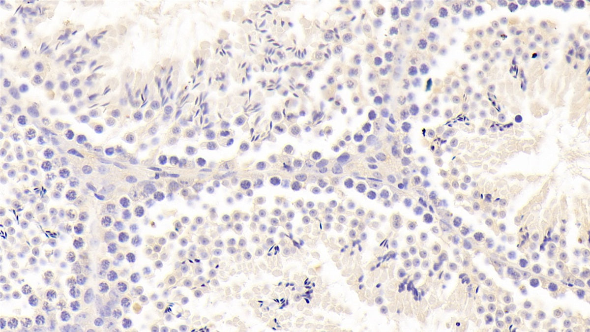 DAB staining on fromalin fixed paraffin-embedded Liver tissue)