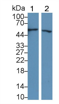 DAB staining on IHC-P; Samples: Human Liver Tissue;  Primary Ab: 30µg/ml   Rabbit Anti-Human C4BPb Antibody Second Ab: 2µg/mL HRP-Linked Caprine Anti-Rabbit IgG Polyclonal Antibody