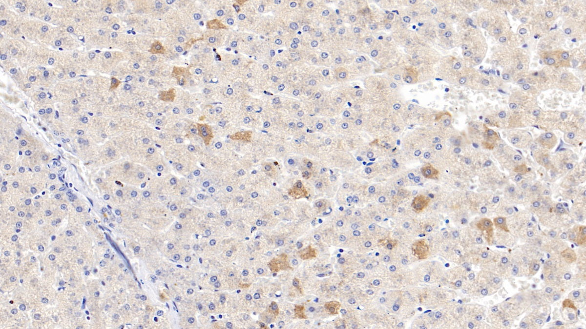 C4 Binding Protein Beta (C4BPb) Polyclonal Antibody - image 4