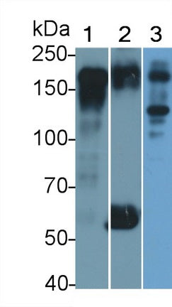 DAB staining on IHC-P; Samples: Human Tonsil Tissue; Primary Ab: 10µg/ml Rabbit Anti-Human EGFR Antibody Second Ab: 2µg/mL HRP-Linked Caprine Anti-Rabbit IgG Polyclonal Antibody