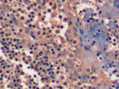 DAB staining on fromalin fixed paraffin-embedded liver tissue)